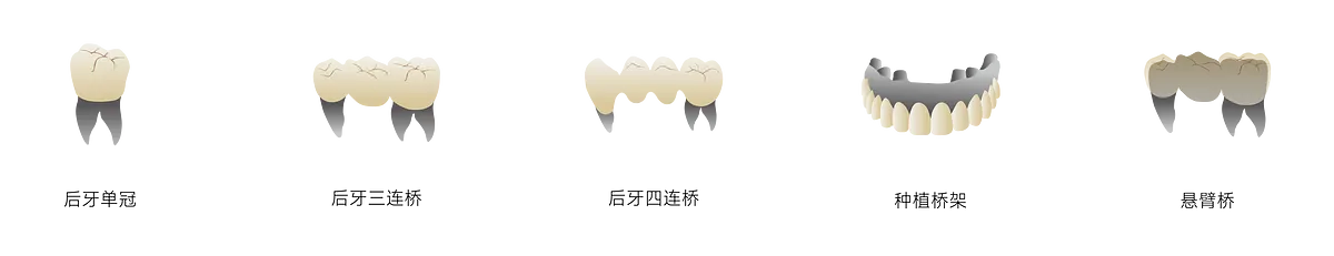 瓷倍健ST-COLOR_畫(huà)板 1 副本 3.webp